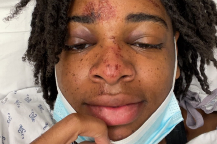 Homan, Steve Homan, Evans, Jazzpher Evans, unconscious, chokehold