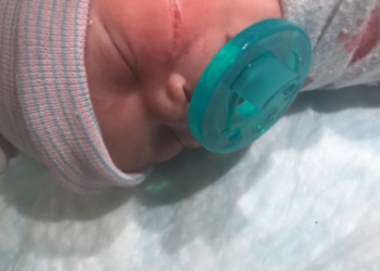 c-section, Denver Health Hospital, cut, newborn, stitches, baby, Reazjhana, Reazjhana Williams