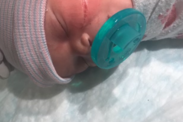 c-section, Denver Health Hospital, cut, newborn, stitches, baby, Reazjhana, Reazjhana Williams