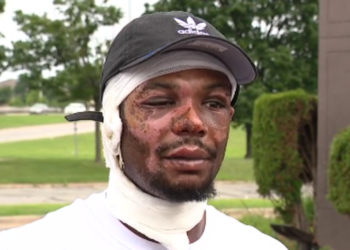 Lucas, Ray Lucas, fire, burn, Detroit, injuries