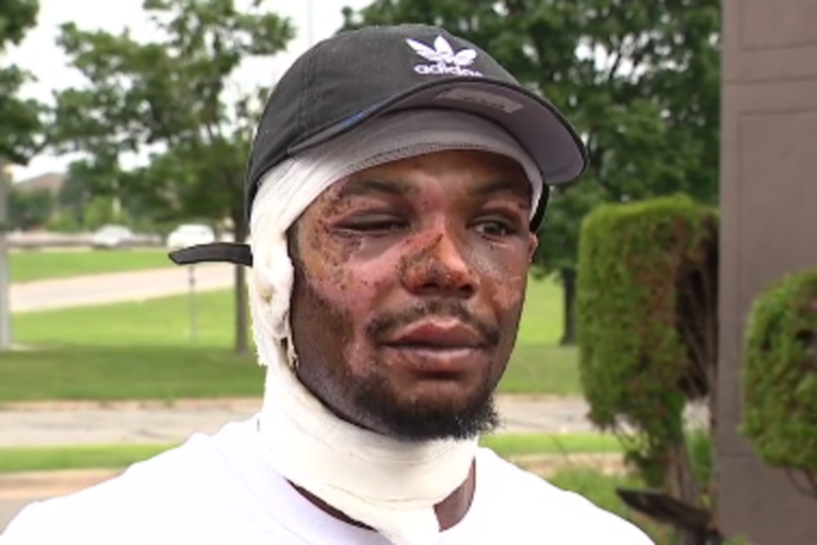 Lucas, Ray Lucas, fire, burn, Detroit, injuries