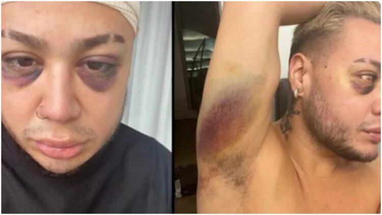 Brandon Hale Nicolas Gallardo